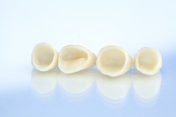 Should I Be Concerned About A Black Line Around My Dental Crown?